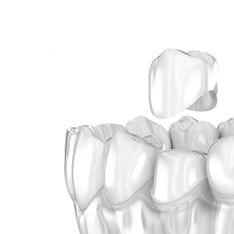 Протезирование