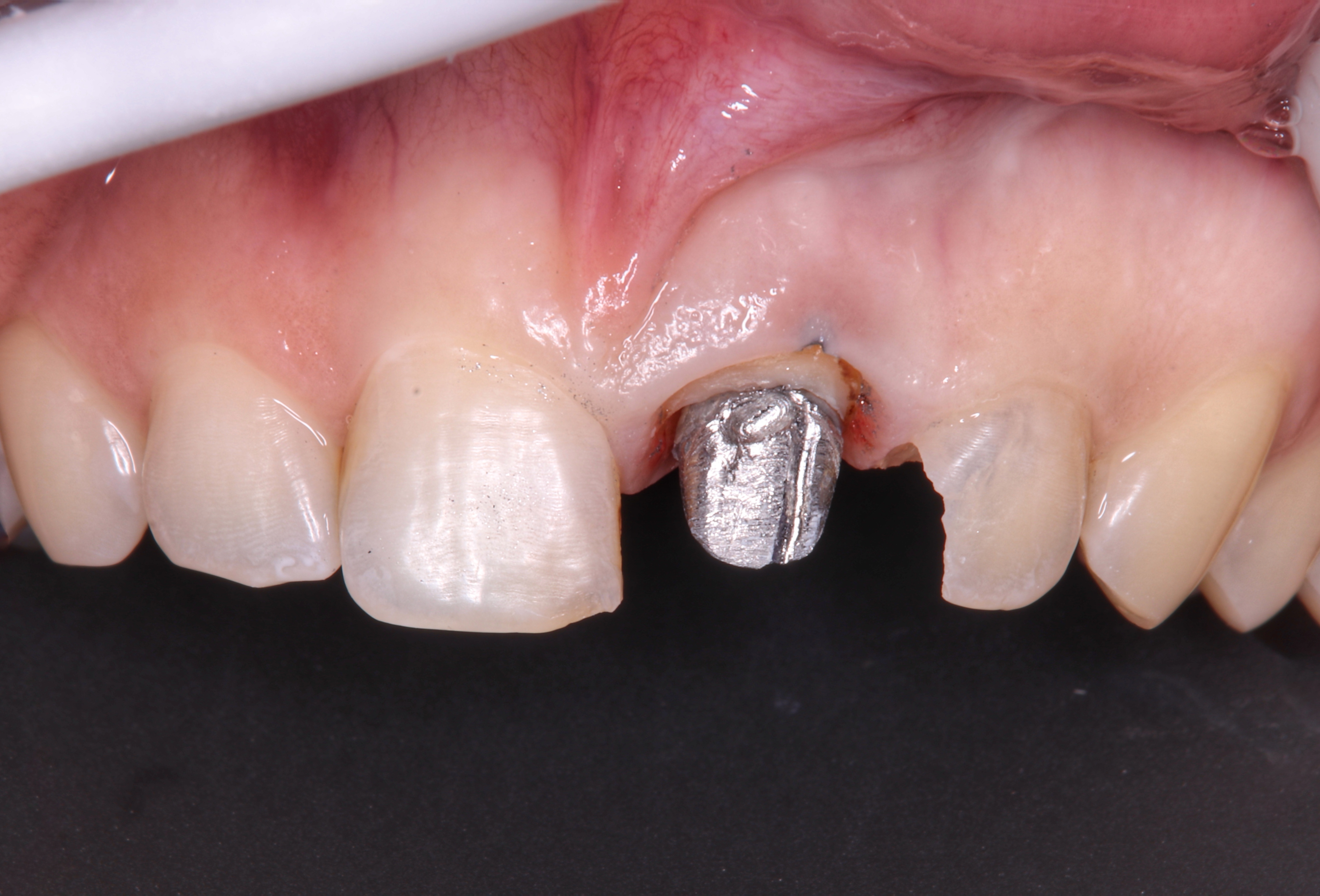 20221205155905 img 5280 03 01